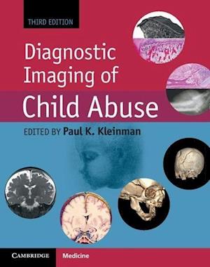'Diagnostic Imaging of Child Abuse' - Bog
