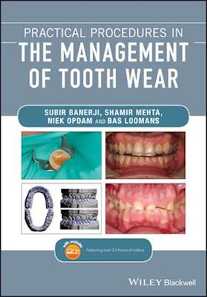 'Practical Procedures in the Management of Tooth Wear' - Bas Loomans, Niek Opdam, Shamir B. Mehta og Subir Banerji - Bog
