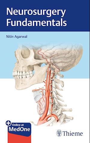 'Neurosurgery Fundamentals' - Nitin Agarwal - Bog
