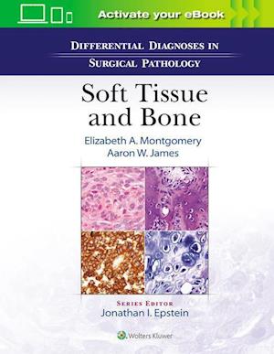 'Differential Diagnoses in Surgical Pathology: Soft Tissue and Bone' - Elizabeth A. Montgomery og Aaron James - Bog