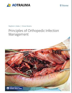 'Principles of Orthopedic Infection Management' - Olivier Borens og Stephen Kates - Bog